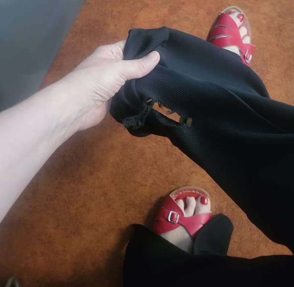 A close-up of my feet in red open-toe shoes with matching red toenails. I'm wearing black trousers and holding up one pant leg toward the camera, showing a visible hole in the fabric.